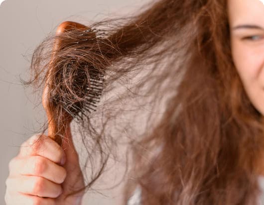 Hair Thinning